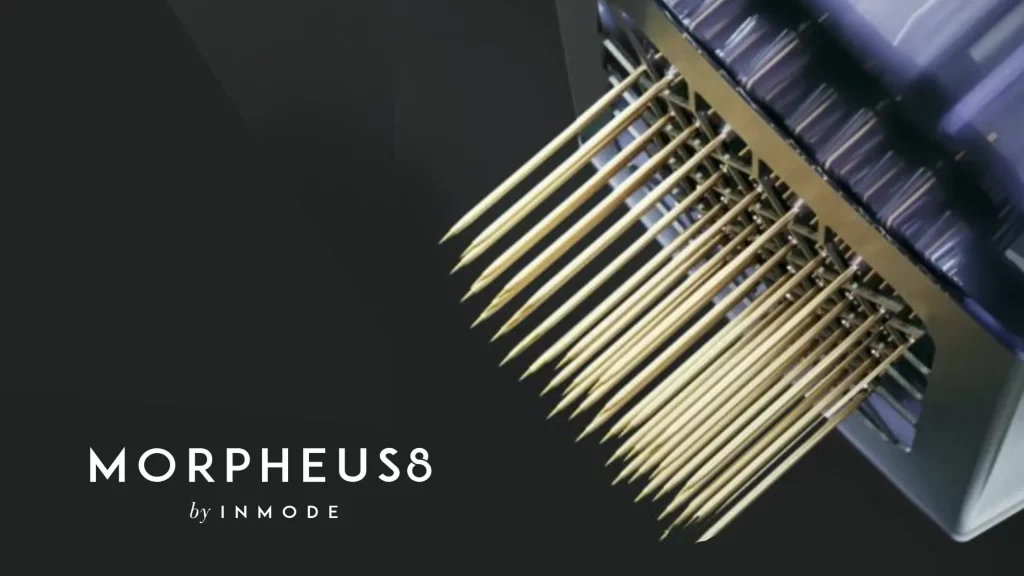 morpheus8 skin tightening treatment