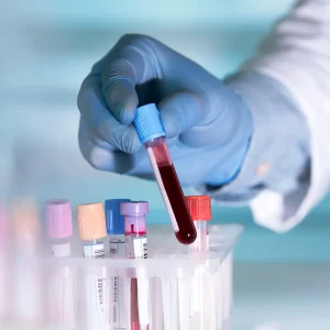 Blood Test Bromley