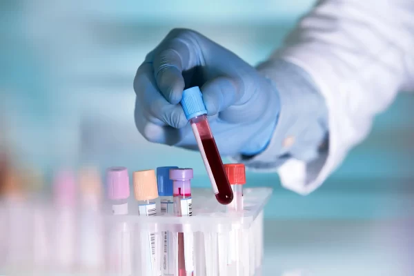 Blood Test Bromley