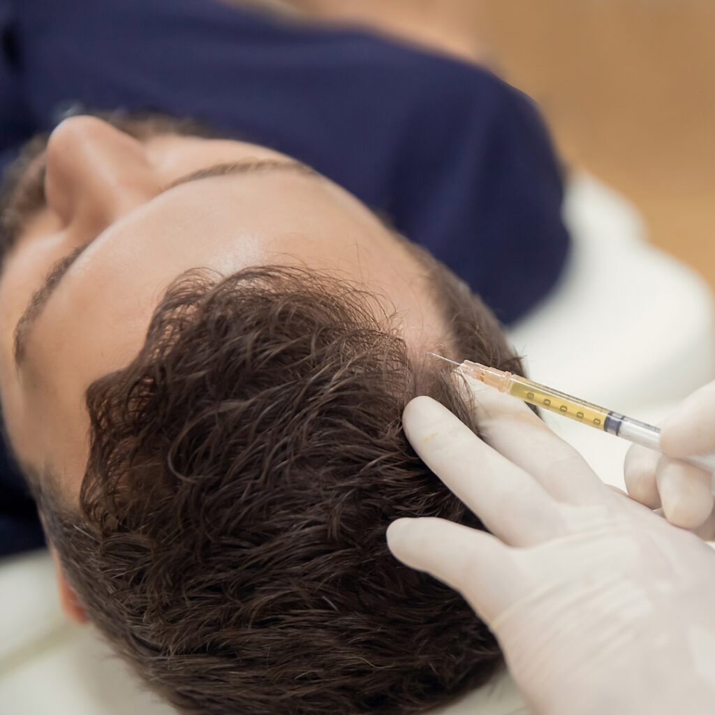 hair loss treatment
