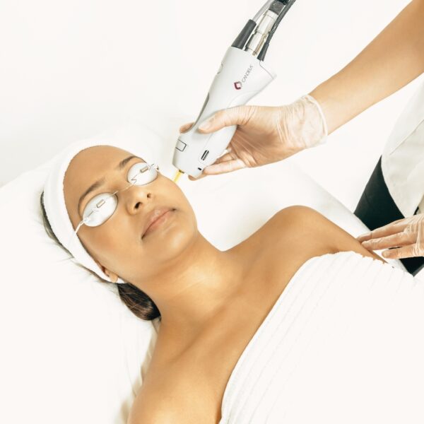 Laser Hair Removal for Dark Skin Hair Free in 6 8 Sessions!
