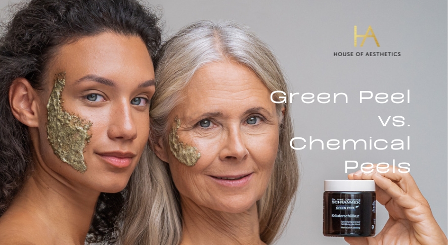 Green Peel vs. Chemical Peels