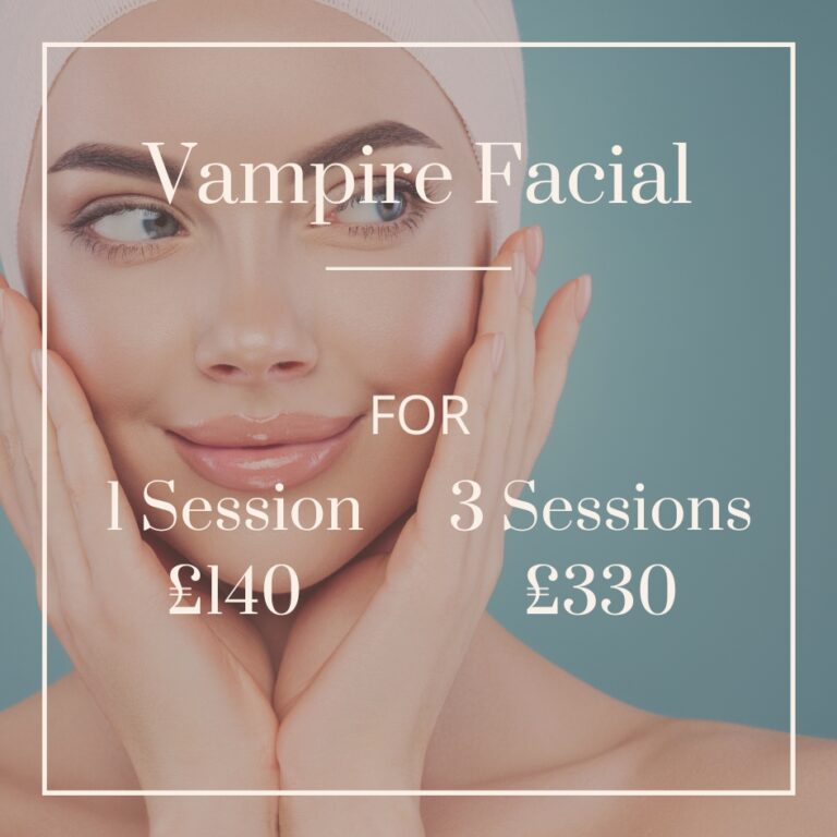 vampire facial treatment offer