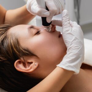 hydrafacial for men in bromley
