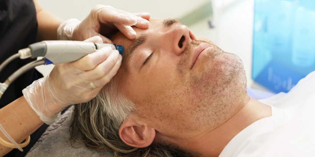 hydrafacial for men in bromley