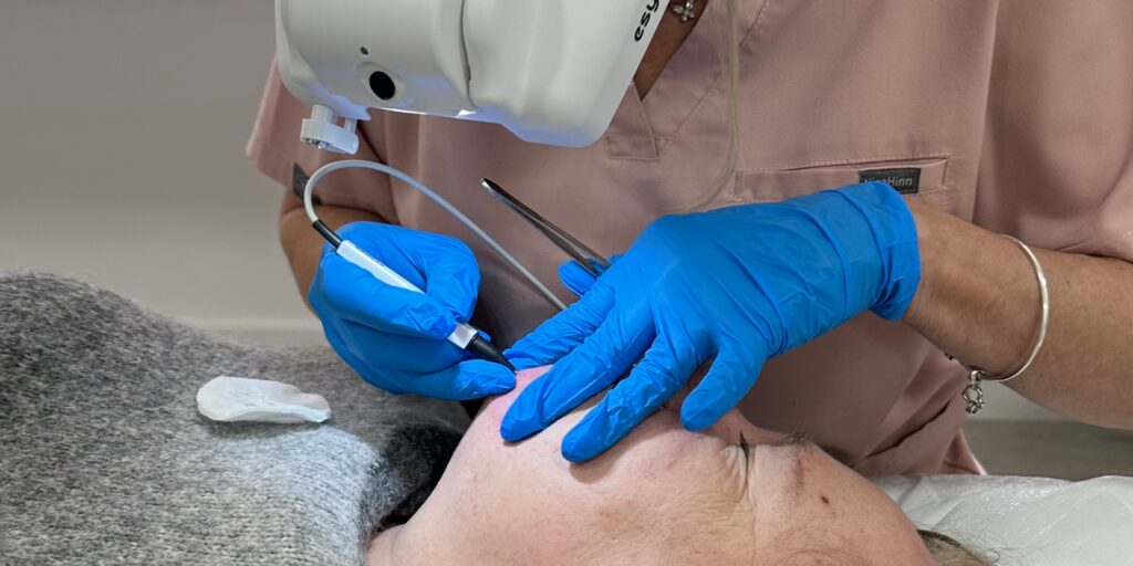 electrolysis blog