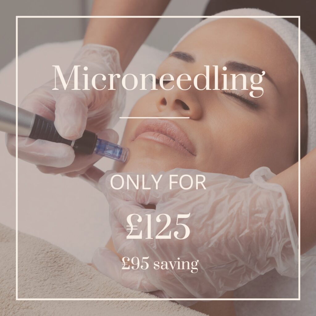 Microneedling may offer