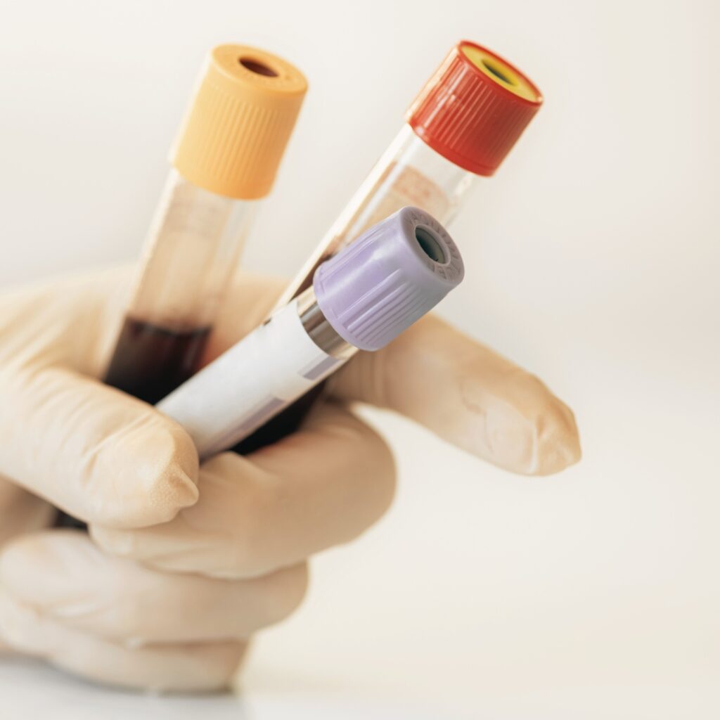 blood tests bromley