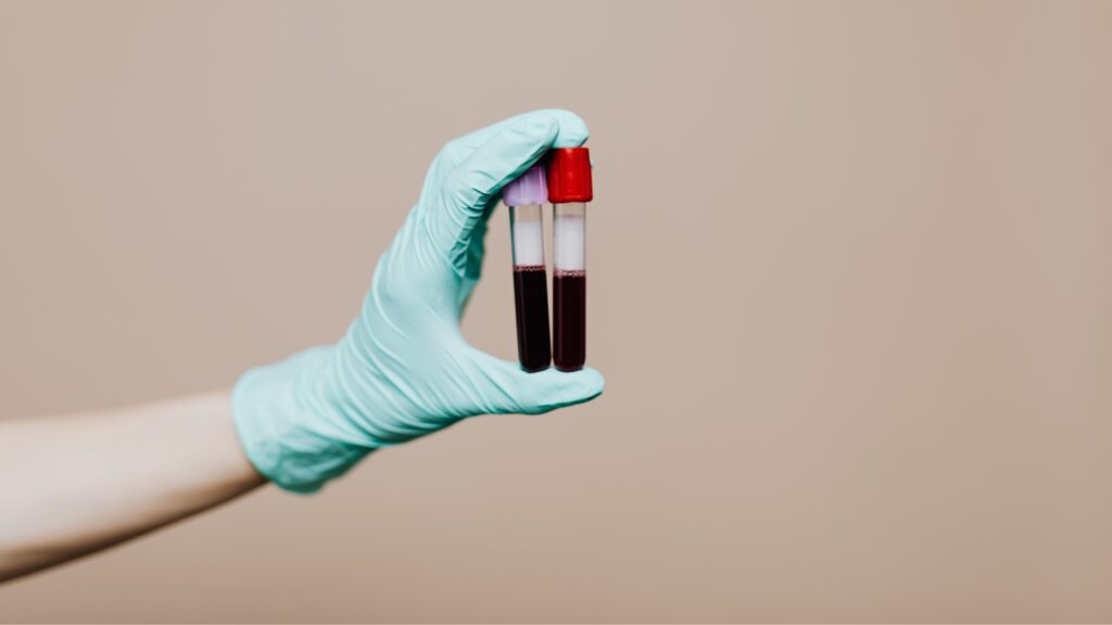 blood test bromley