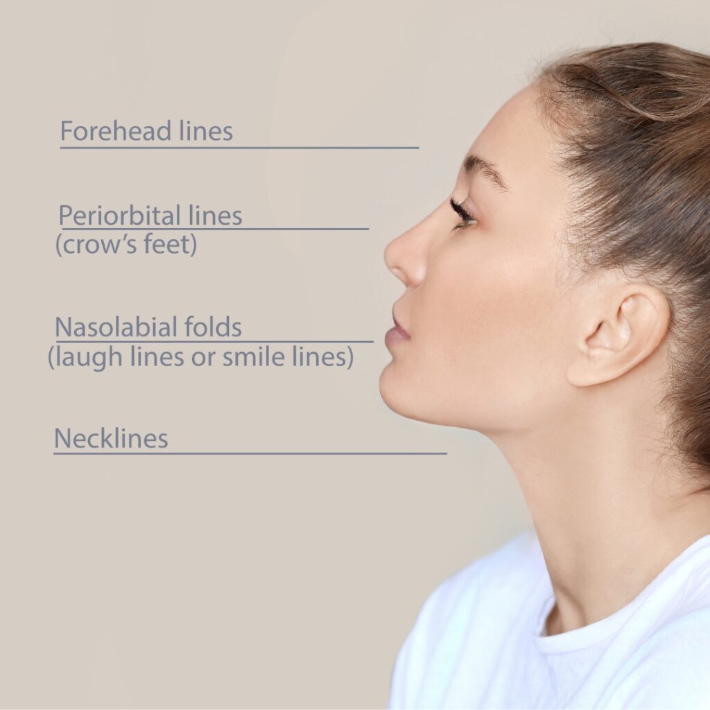 dermal fillers bromley