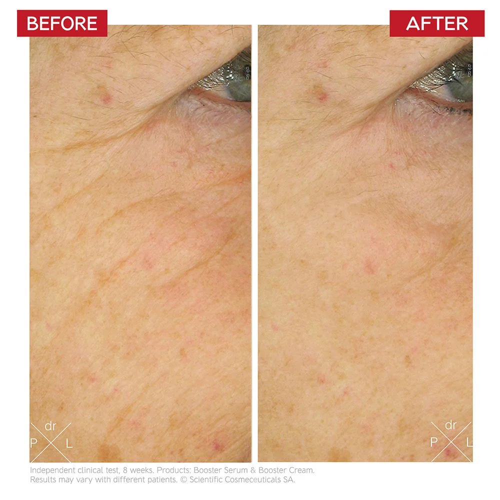 dr-levy-switzerland-skin-care-beauty-product-booster-cream-before-after