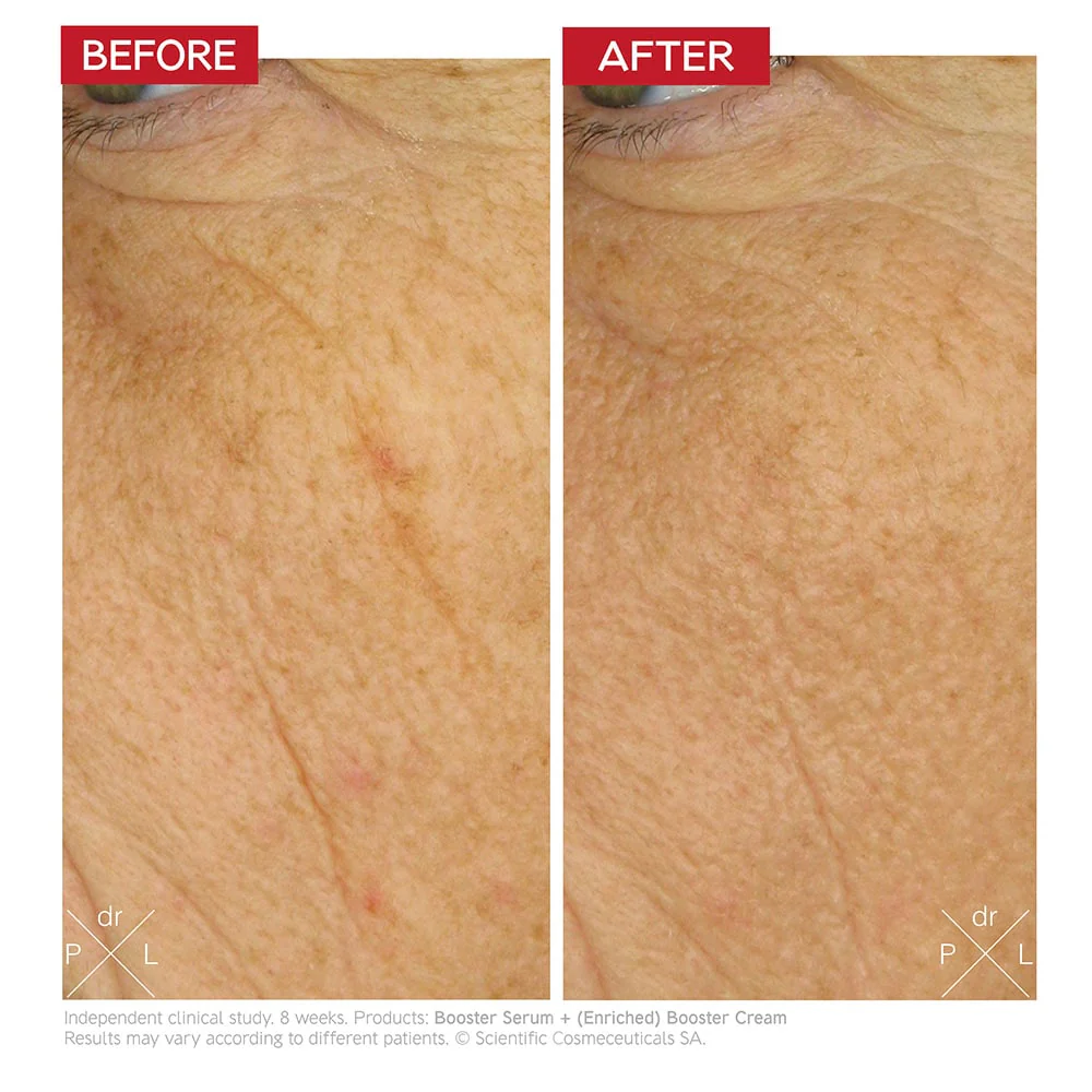 dr-levy-switzerland-skin-care-beauty-product-enriched-booster-cream-before-after