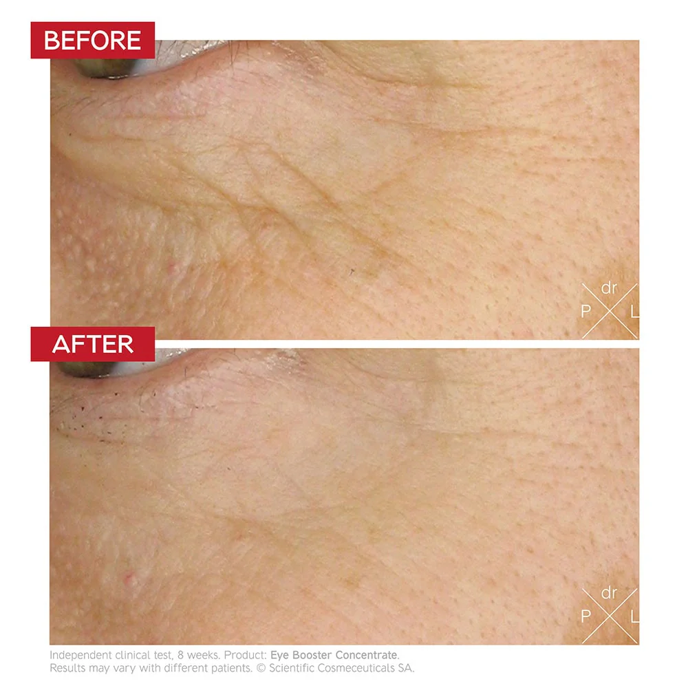 dr-levy-switzerland-skin-care-beauty-product-eye-booster-concentrate-before-after_dde7808e-c6c6-4c61-a73c-4f51e4b3b8b1