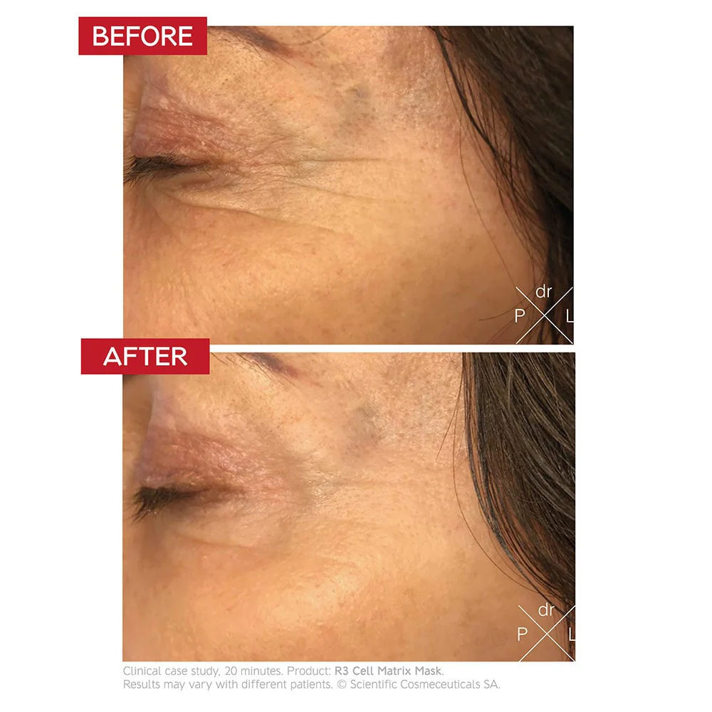 dr-levy-switzerland-skin-care-beauty-product-r3-cell-matrix-mask-before-after
