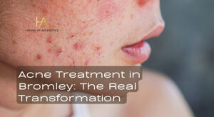 [Homepage] - House of Aesthetics - No1 Aesthetics Clinic