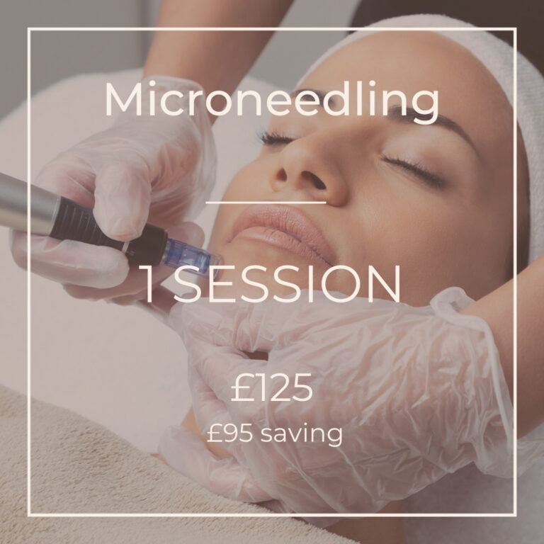 microneedling offer bromley