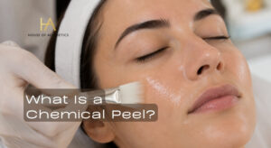 What Is a Chemical Peel and Which Type Is Right for Your Skin