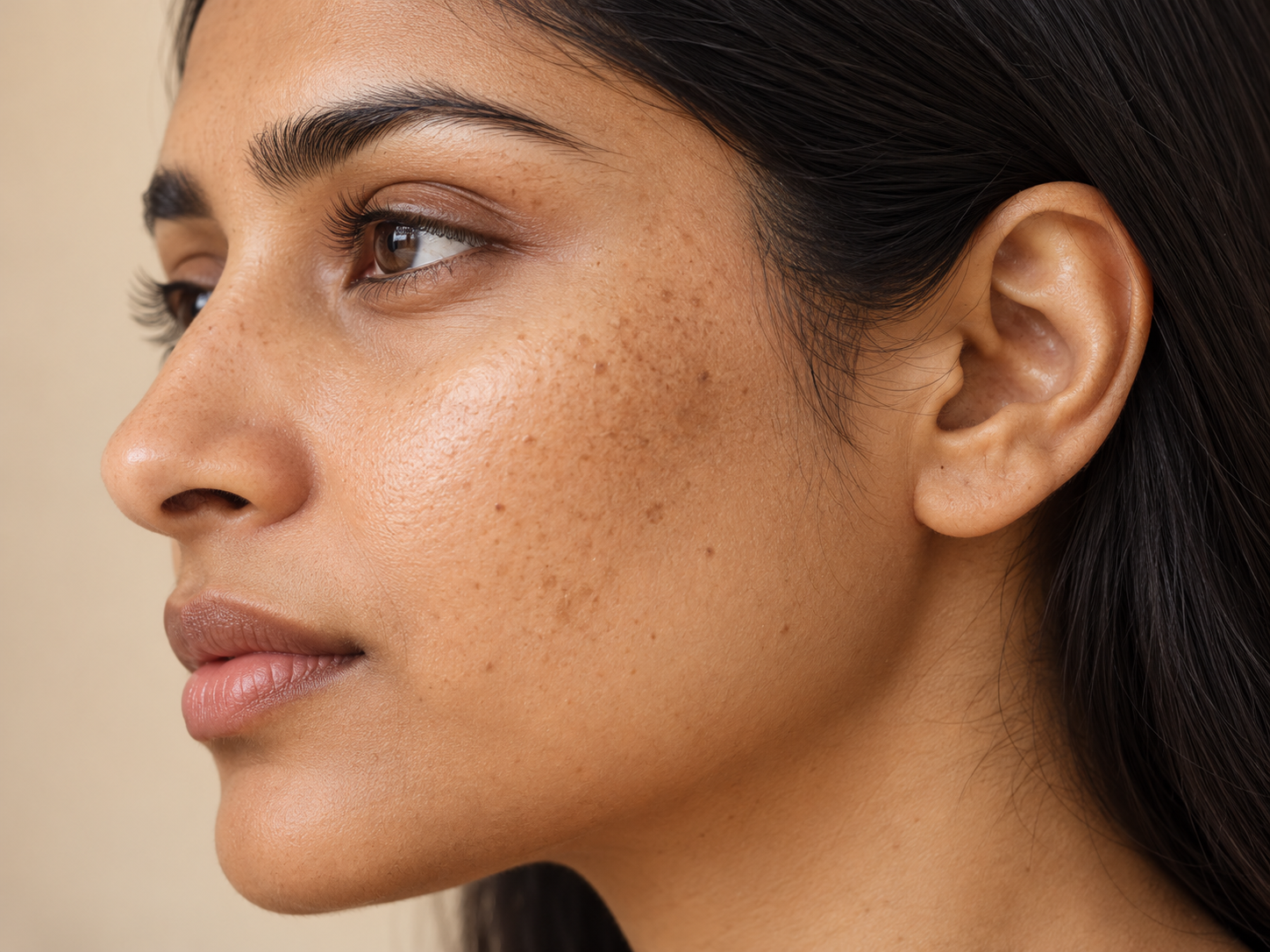 Woman's cheek with freckles and uneven pigmentation